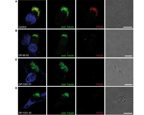 香港验血是女孩 结果B超是男孩,山西试管婴儿排名医院有哪些？医院/费用/成功