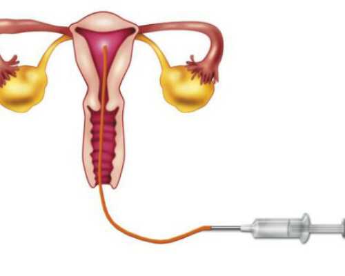 二胎去香港验血邮寄,2026泰国试管婴儿攻略索引：直营，授权与中介的区别