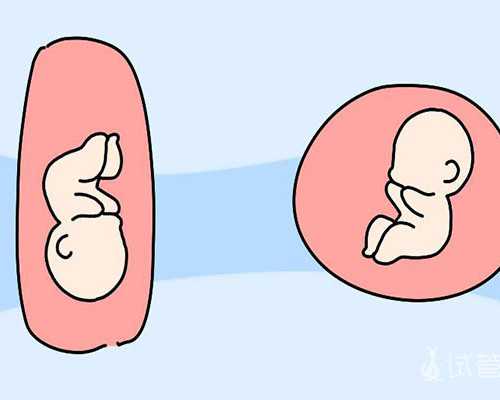 香港验血一定要满7周吗,可以在宿迁本地医院做试管生双胞胎吗?