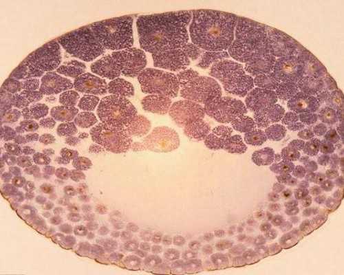 吹洗泵是什么东西,银耳炖燕窝｜银耳莲子羹