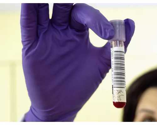 污水泵生产厂家,大腿肌肉麻木疼痛是怎么回事