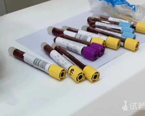 香港验血为什么寄到深圳,香港私立医院能预约验血性别吗_查男女需要什么条件