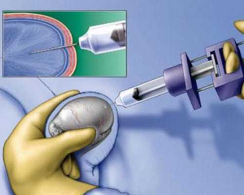 吃了个包子 在香港验血准吗,香港验血查男女生了,很准别不信!这是真的，我的
