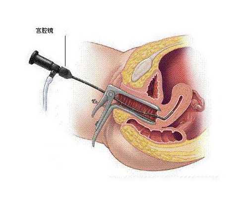 香港dna化验血样能发快递吗,怎么寄血样去香港查宝宝性别_验男女是真是假到底