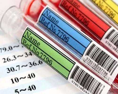 有没有快递到香港验血的,香港验血女孩有翻盘_正规医院香港验血报告单真假