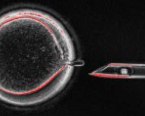 香港验血多少天可以去,香港验血查性别的机构_验血查男女要几周看完你还做吗