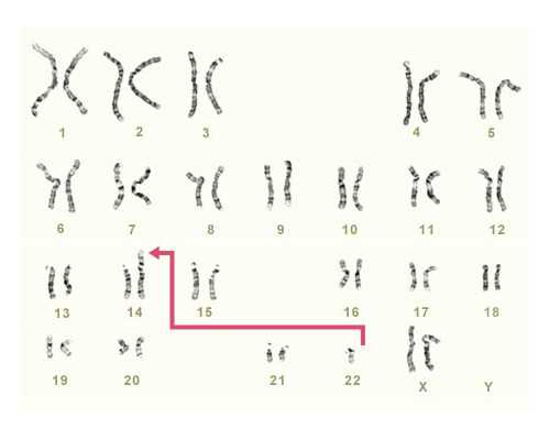 香港孕几天可以验血,验血查胎儿性别准确吗？验血没有y一定是女孩吗？