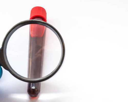 香港验孕验血报告单怎么看,在重庆助孕试管婴儿治疗中放松的6种方法