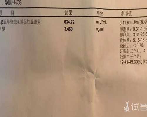 香港验血检测结果不一样,香港验血测男孩女孩都准的吗_胎儿性别几天出可以出