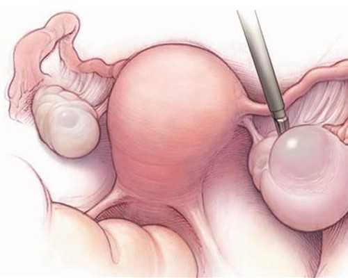 微泵主要有哪种泵,女命日坐七杀的婚姻如何