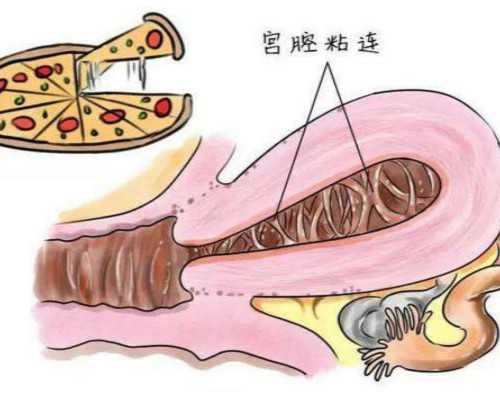 香港验血男女要多久才能知道结果,卵巢早衰但有成熟卵泡为什么怀不上?促排