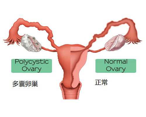 香港诊所能验血吗,【子宫肌瘤供卵试管儿能成功吗】超快顺产女宝，详细顺产