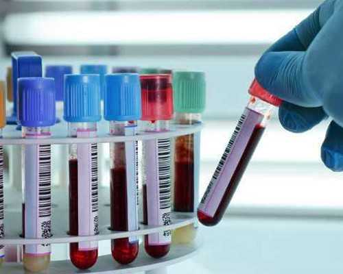 离心泵平衡盘的工作原理,减肥究竟该怎么减