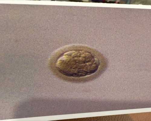 香港验血鉴定男女多久拿结果,香港40天查胎儿性别_验血查性别要到哪预约!