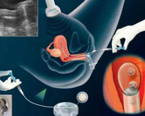 孩子已出生 怀孕在香港验血,怀孕一个多月去香港验血查男女准吗_验血查男女抽