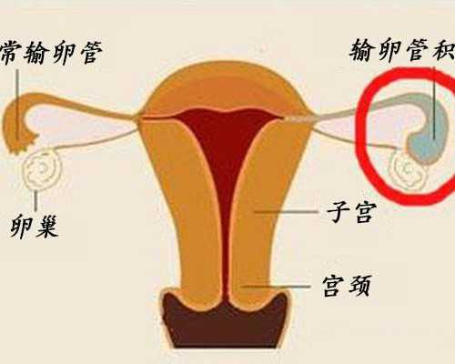 孕妇香港验血要多久,【供卵试管婴儿属于自己孩子吗】经历生化子厚后卫卵泡