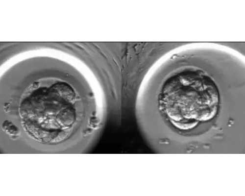 泵车价格表 三一重工46米,教你在举手投足之间变苗条