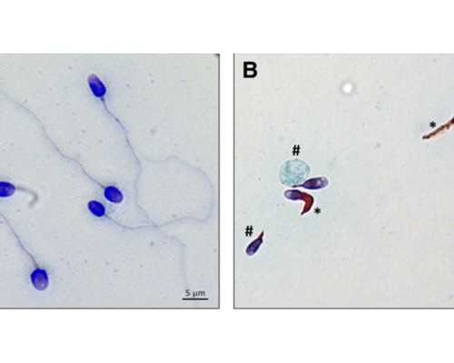 香港验血当天能有结果吗,全国试管婴儿医院排名，前10在这里了