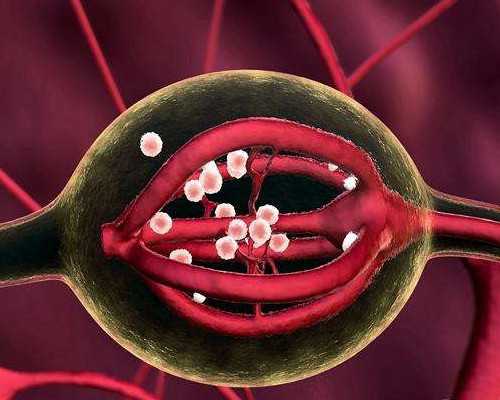 冷却水泵选型,过敏性鼻炎吃过敏药有用吗