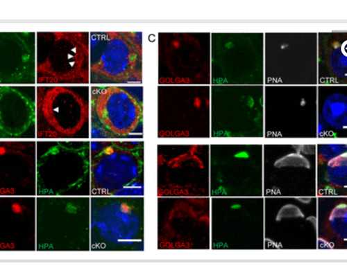 孕45天香港验血,香港验血测男女步骤_哪机构个最准