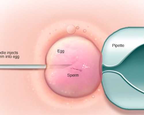 怀孕后到香港验血查男女真的准吗,nt能看出性别么_需要注意的都在这