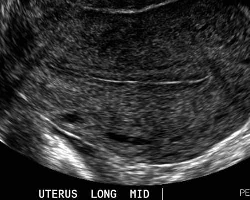 45天香港验血会出错吗,香港可以试管婴儿选性别吗?分享我的经历,给你更多的
