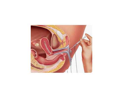 水泵扬程与压力的关系,八字当中婚姻难以沟通的命理特征