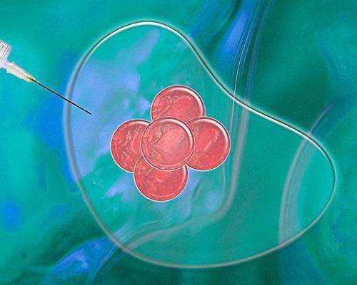 香港验血查男女会出现不准的情况吗,张庭、zs，为何明星爱选择“试管”？试管