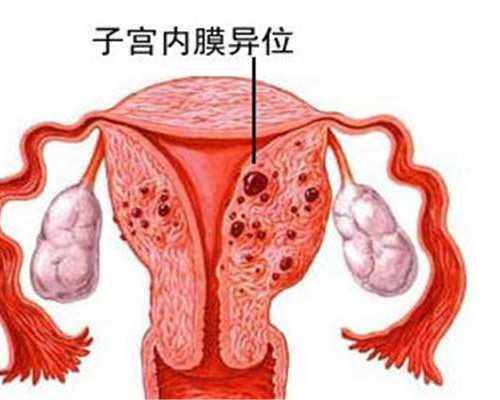 如何邮寄香港验血,不提倡正常人做试管婴儿，自然受孕最好