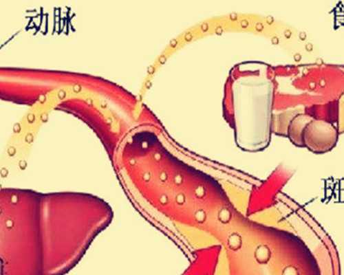 泵感健身 万达茂,啤酒肚是怎么形成的