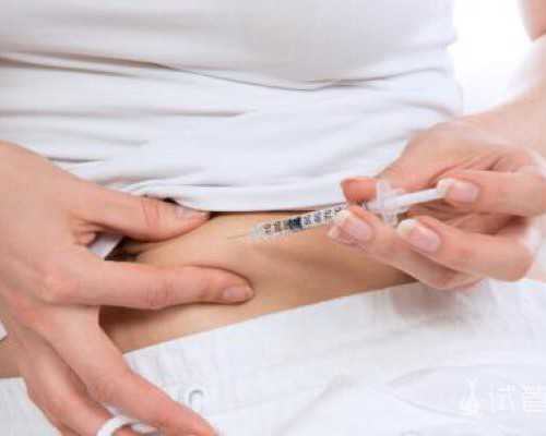 汽车汽油泵继电器英文缩写,单臂正握下拉