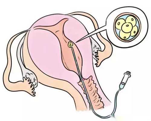 吃了个包子 在香港验血准吗,去香港验血查胎儿性别流程,本人亲身经历告诉你