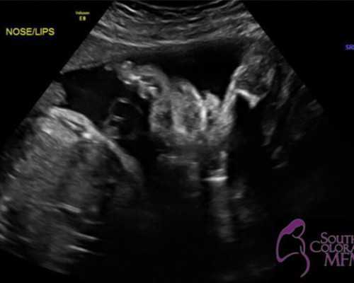 气动活塞泵,梦见鲨鱼是什么意思做梦梦到鲨鱼好不好