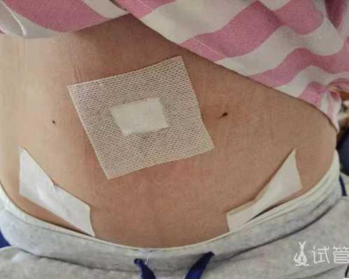 香港验血鉴定男女西安哪里有,女性经期咳血是怎么回事？会是子宫内膜异位症