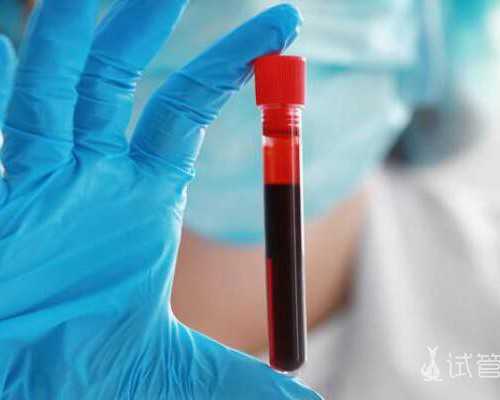 输液泵价格,84年海中金命适合做什么行业,海中金命适合的工作领域