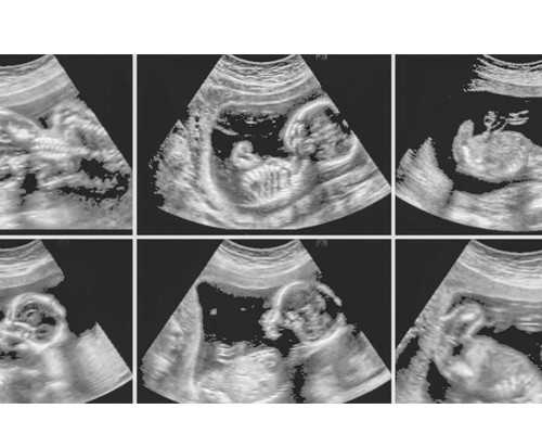 泵 厂家排名,如何化解小人最灵最有效犯小人的含义