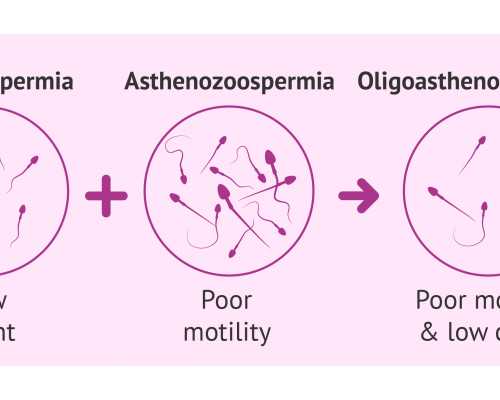 化工离心泵企业,燕麦的夏季养生吃法
