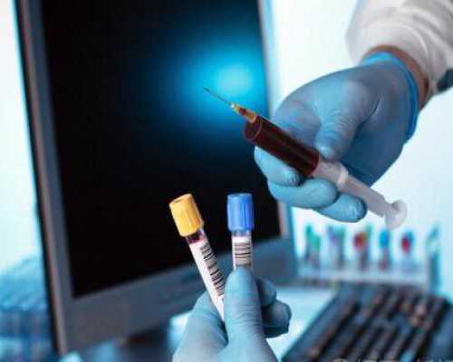 香港验血可以邮寄过去吗,直接做试管的条件:射出来的**颜色发黄，要怎么检查