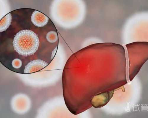 胰岛素泵act是什么意思,谈恋爱时会出现自卑心理的星座