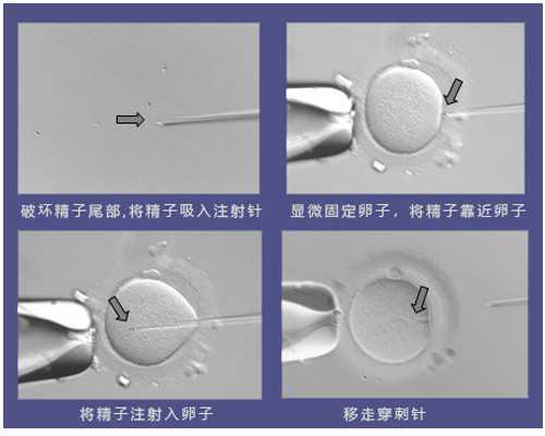 怀孕16周可以香港验血,关于父爱的作文给一篇写父爱的作文