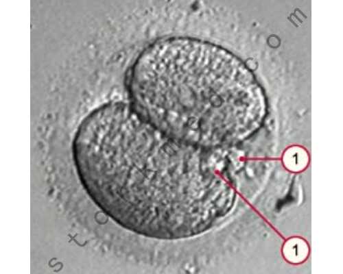 香港邮寄验血只有罐没有冰袋,去香港验血孕10周准不准_验血查性别会翻盘吗